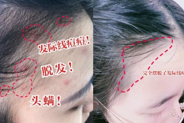 是吹干好？10分钟轻松养成女明星「绸缎发」mg不朽情缘游戏登录入口洗完头自然风干还(图3)