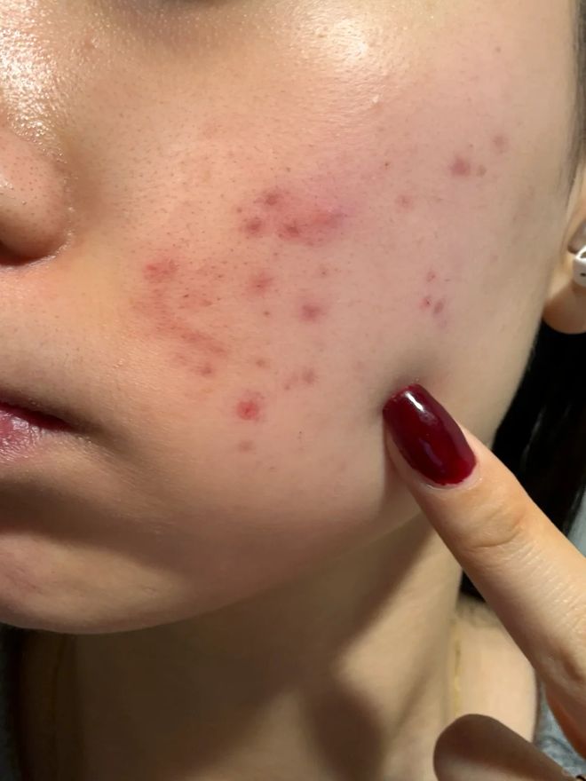 换了？这种毛巾建议马上换掉不朽情缘版你家的毛巾多久没(图4)